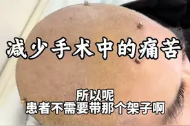 患者56岁，男性，经过我们详细的术前检查评估诊断为帕金森病，我们在今日全麻下行机器人引导下脑深部电极电刺激器置入术#脑起搏器手术 #神经外科 #帕金森视频封面