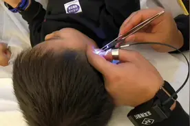 这个小朋友有两个耳结石，很幽默的小家伙！#采耳 #养生 #健康