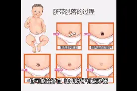 新生儿脐带渗血的原因#希望这个视频对大家有所帮助视频封面