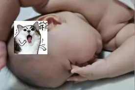 吓死老母亲，因为吃手戳到眼睛。惊了个呆#记录成长的每一个瞬间视频封面