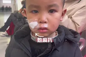#生活vlog日常记录 #带娃出行 #疤痕治疗 #北京八大处视频封面