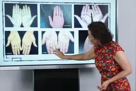 手上这个部位发黑要警惕！可能是肿瘤和癌症，看不见就危险了