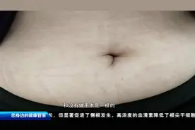 罕见！50多岁女士肚子大如球，像怀孕7个月，这到底是怎么一回事视频封面