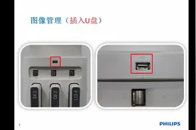 飞利浦超声-Sparq操作-图像管理（回顾、导出）