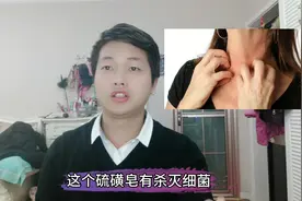 硫磺皂到底对皮肤湿疹有没有作用？一旦用错，对皮肤伤害很大！