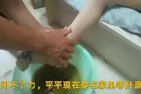 7岁肝癌晚期，脚肿的走不了路，煮艾叶水给她泡脚，希望能消肿视频封面