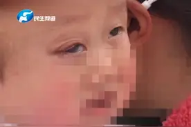牛眼一样！孩子刚出生 眼球有大有小？