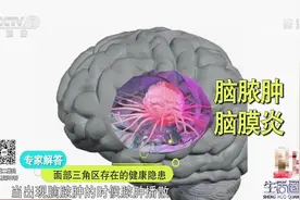 生活圈：面部三角区的痘痘不能挤，为啥呢？专家讲解原因，太危险视频封面