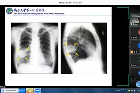 临床常见X线检查结果的判读讲课视频视频封面