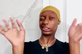 第一次戴隐形眼镜你，是否也是这样~ 痛不欲生