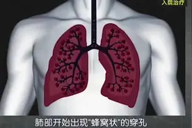 新冠肺炎病毒是怎样侵入人体细胞的，看完你就明白了！