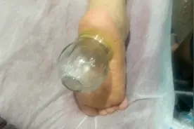 残疾人按摩店日常，按摩足跟痛手法分享，按摩我们是认真的