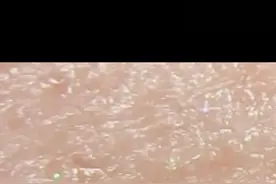 看似光滑的皮肤放大1600倍后会发生什么？视频封面