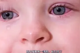 经常流眼泪好不好？专家放大1000倍后，感觉还非常的别致
