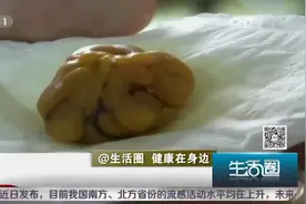 生活圈：杀鸡肚中现“鸡宝”价值数千万，这是真的吗？听专家咋说视频封面