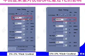 【MRI成像技术指南5】磁共振MR快速采集技术视频封面
