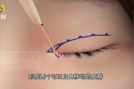又称开眼角的内眦扩大术,瞬间无痕变大眼,你也是女神