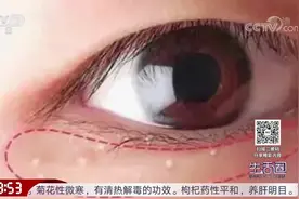 生活圈：如何去除眼部周围的汗管瘤？专家帮您支招，一起来看一下视频封面
