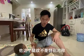 宝宝七个月了，父母发现宝宝腿纹不对称，宝爸很自责，怎么办？视频封面