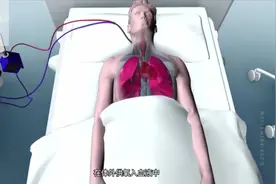 人工肺，ECMO。德国有750台，240台在使用视频封面