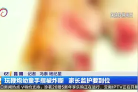 玩鞭炮幼童手指被炸断 家长监护要到位视频封面