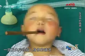 真相123:孩子不小心将异物戳进身体该咋办？专家分享正确处理方法视频封面