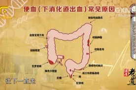 健康老友道：引起肠道出血的原因有哪些？视频里全都总结全了视频封面