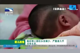 小孩脑后颈上部位头发稀少，是因为缺钙吗？