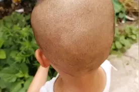 小孩长痱子，农村大姐用一把树叶，轻松解决问题！视频封面