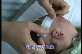 静脉输液法--临床医师技能操作视频封面