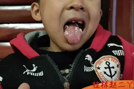 儿子舌头好花烂完，去医院医生说这病没有药卖，到底吃啥药才有救视频封面