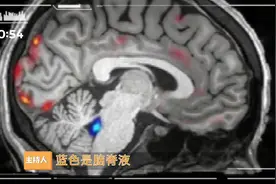 熬夜变傻有证据！科学家拍下“洗脑”过程，睡觉时大脑会清理毒素