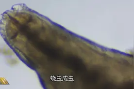 蛲虫儿童常见的肠道寄生虫，在显微镜下看到数以万计的虫卵