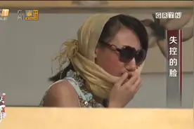 整容女毁容！躺在医院肠子都悔青：再也回不去！丨真实故事视频封面