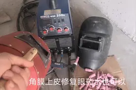 电焊弧光打到眼睛疼痛怎么办？用这几个小妙招可以快速止痛视频封面
