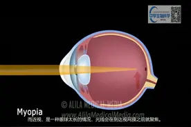 眼球结构成像原理以及近视远视成因视频封面