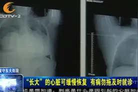 七旬婆婆心脏是正常人的3倍大！究竟为何？医生：随时有猝死危险视频封面