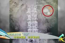 生活圈：牛奶切勿与这几类食物同食，否则会产生肾结石，为啥呢？视频封面