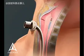 医学3D动画演示：认识气管切开术
