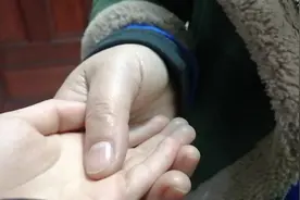 小儿推拿之小儿肺热咳嗽推拿手法，简单易学