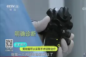 生活圈：黄斑瘤勿忽视，它是早期胃癌的预警指标？听听专家的解答