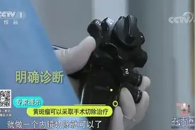 生活圈：黄斑瘤勿忽视，它是早期胃癌的预警指标？听听专家的解答视频封面