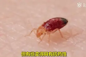 藏在被子里“吸血鬼”——床虱视频封面