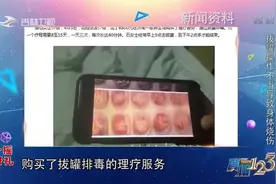 真相123：拔罐为什么拔出水泡，这与哪些因素有关？专家做出解答视频封面