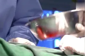 产科医生：产后清洗腹腔，直接拿一盆水倒进去，看呆了视频封面