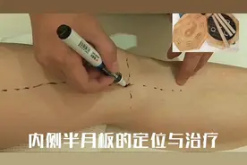 临床实战：内侧半月板的定位与治疗视频封面
