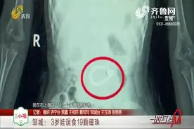 3岁娃直喊肚子疼，打针吃药喝热水都不管用，到医院一拍片吓坏了视频封面