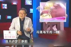 王刚讲故事：刚出生的三胞胎，竟被丢垃圾场压缩后，奇迹生还视频封面