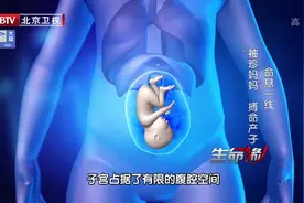 袖珍母亲1：孕妇患侏儒症，搏命产子，面临大出血的威胁|生命缘视频封面