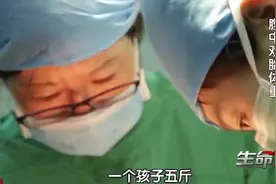 女子怀了双胞胎，两胎儿相差悬殊，大胎儿竟不断吸取小胎儿的血视频封面